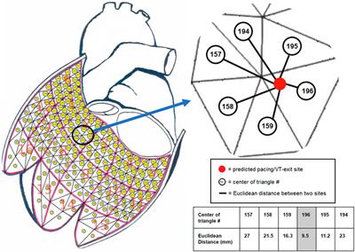 Improving localization accuracy for non-invasive automated early left ventricular origin localization approach